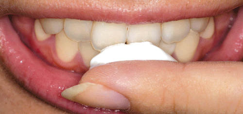 MI-Paste-Application